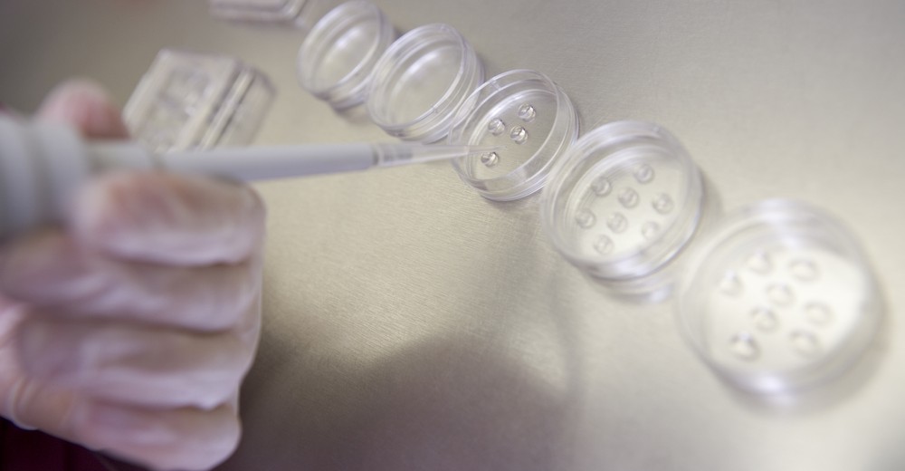 ΕΞΩΣΩΜΑΤΙΚΗ ΧΩΡΙΣ ΦΑΡΜΑΚΑ