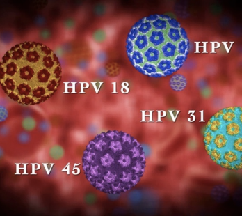 HPV -ΤΙ ΠΡΟΚΑΛΕΙ